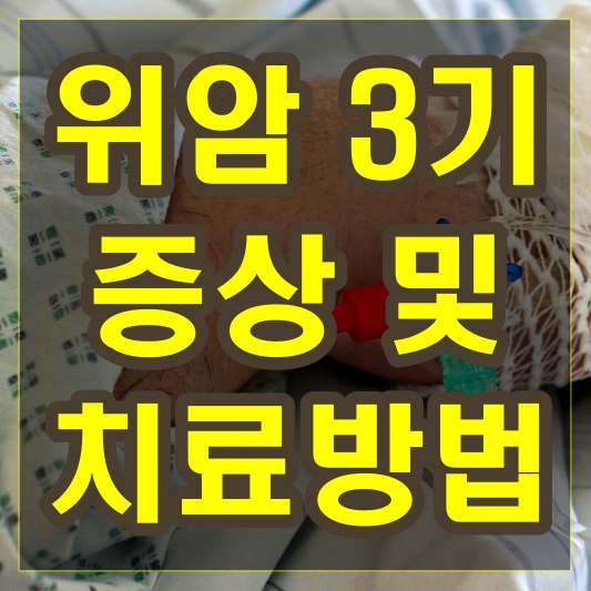 위암 3기 증상 및 치료방법