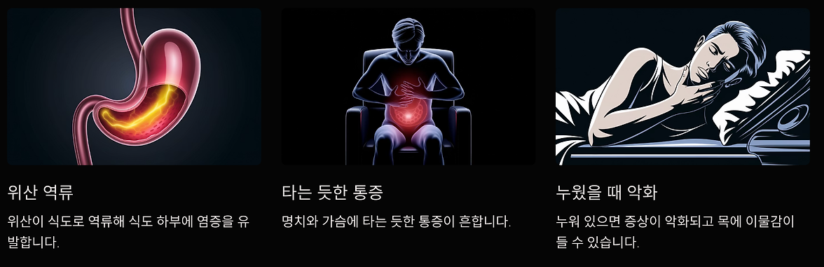 역류성 식도염
