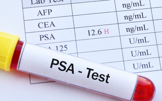 psa-test