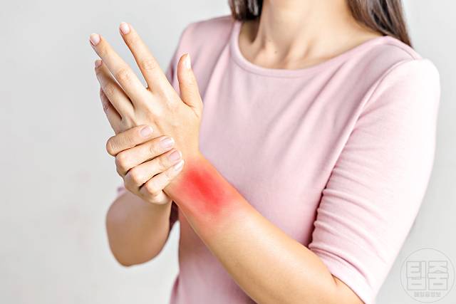 넘어져서 손목이 부었을때 손목통증 삼각섬유연골파열 증상