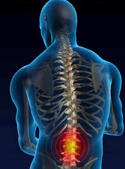 하부 등(요추) 통증 원인