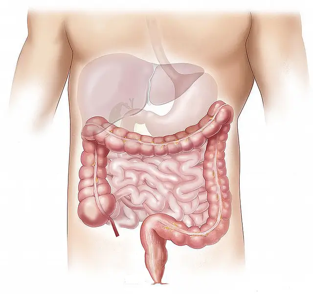 대장에서 발생하는 선천성&#44; 허혈성&#44; 염증성 장질환과 대장암