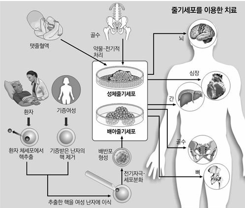 지방 줄기세포의 모든 것 관련 이미지