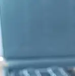 백내장 초기증상 백내장이란 무엇인가 &mdash; 눈 속 렌즈가 흐려지는 순간