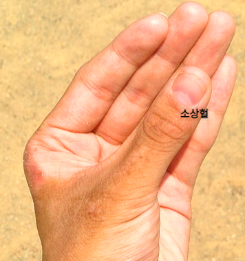 체했을때 손따기