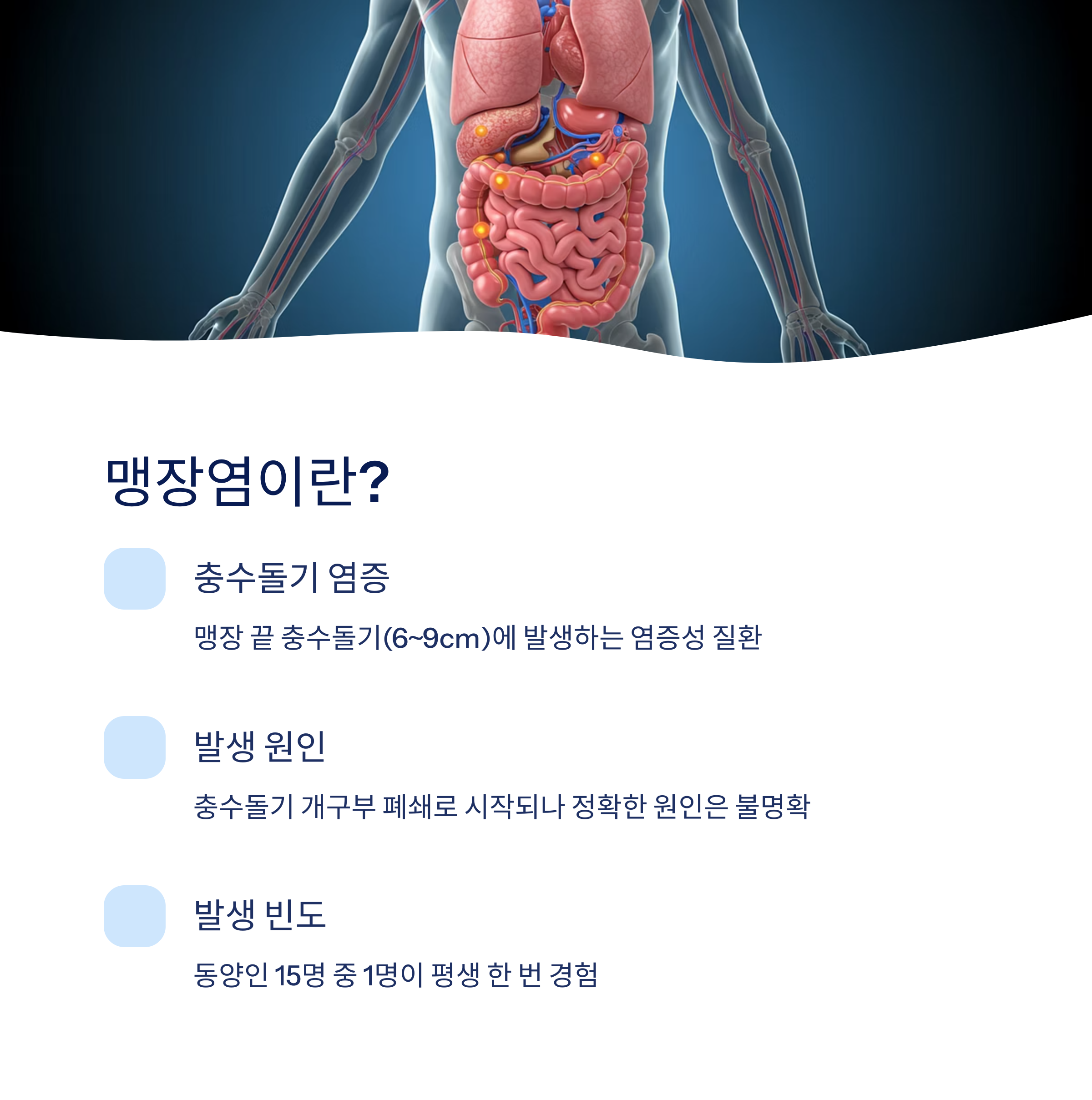 맹장염이란?