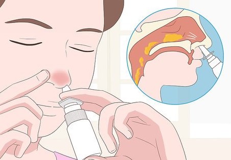 코막힘 뚫는법 지압 2가지 방법 및 막힌코 스프레이 약 강력 추천