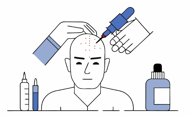 두피문신하는 전과정