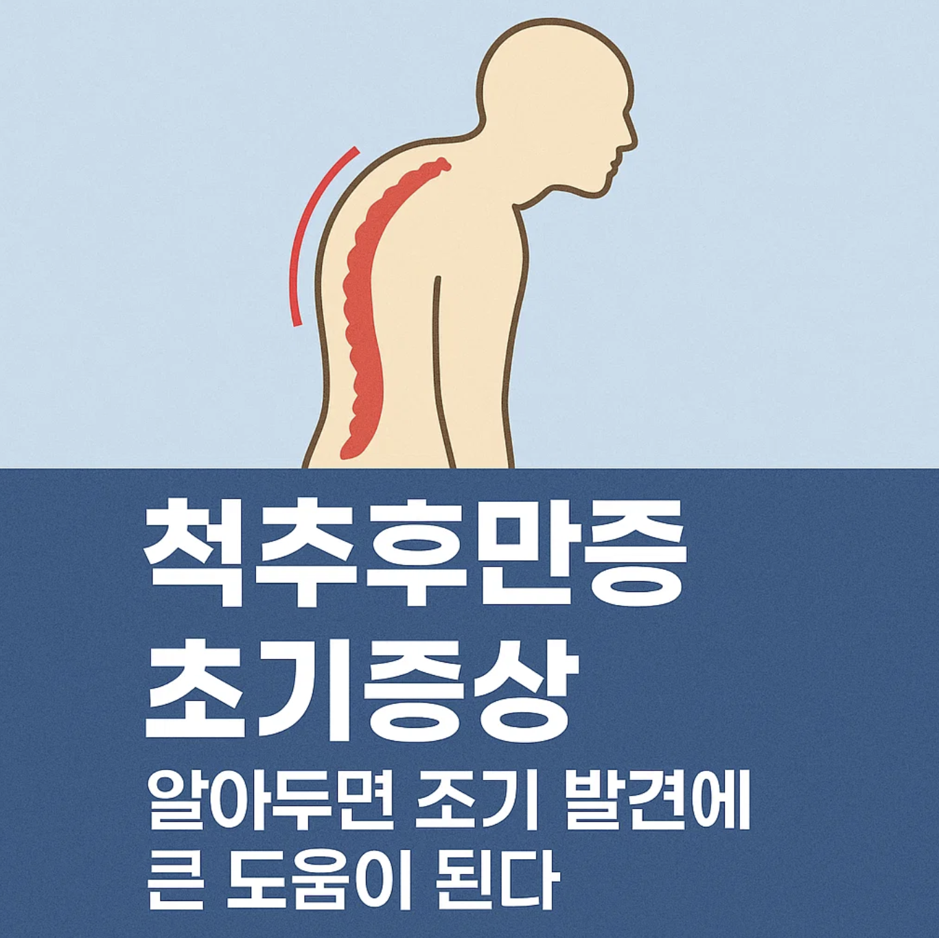 척추후만증 초기증상 알아두면 조기 발견에 큰 도움이 된다