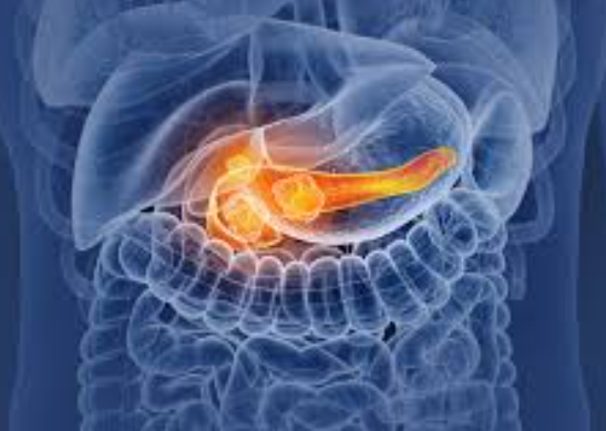 췌장암 증상 및 예방방법