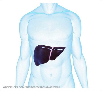 간암 초기증상 및 간암 원인, 치료방법 예방법