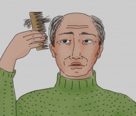 탈모 이미지