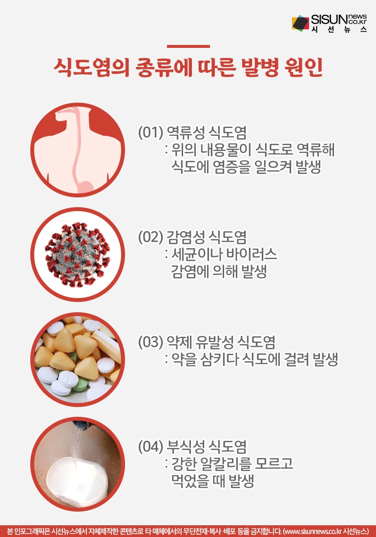 역류성 식도염 초기증상&amp;#44; 가볍게 넘기면 관리가 어려워지는 이유