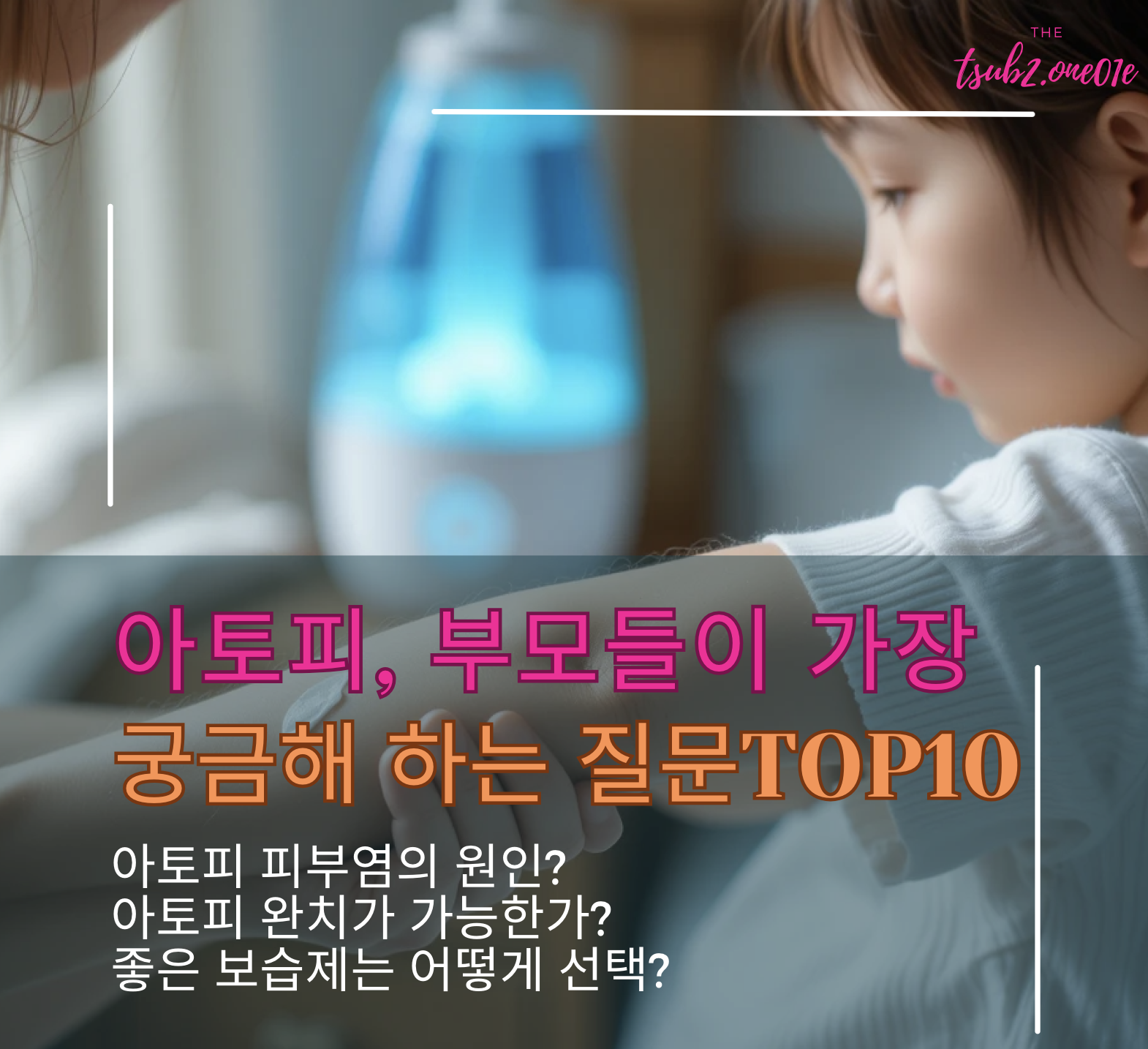 아토피, 부모들이 가장 궁금해하는 질문 TOP 10