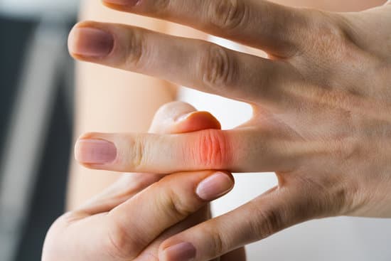 건초염(De Quervain's Tenosynovitis) &ndash; 원인, 증상, 진단 및 치료 방법