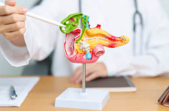 담낭염의 증상, 담낭 용종