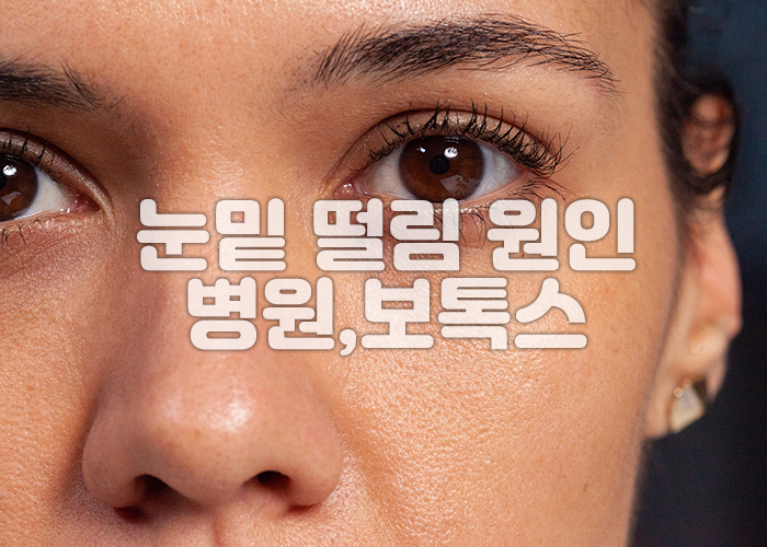 눈밑 떨림으로 보톡스 시술을 받고 증상이 호전된 여인의 정면 모습 이미지