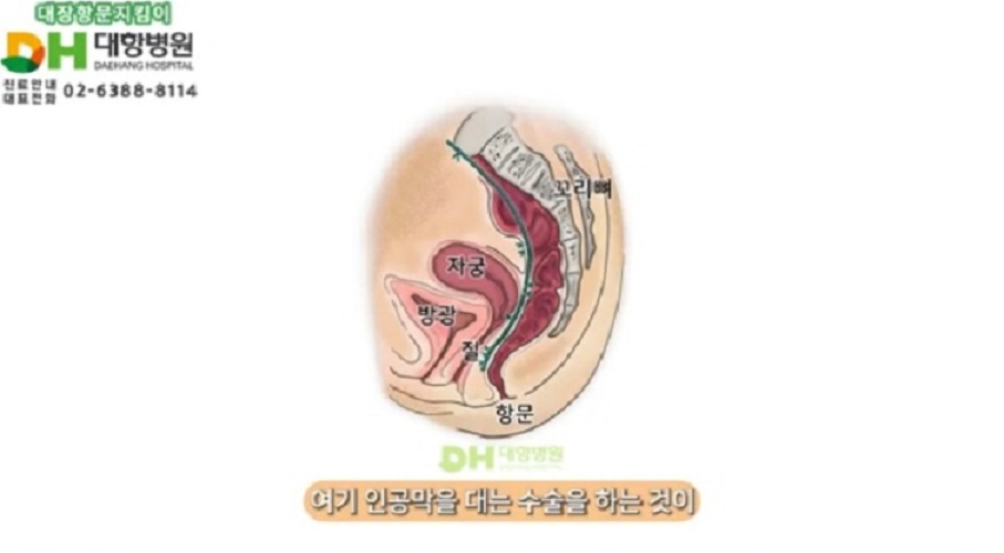 대장명의