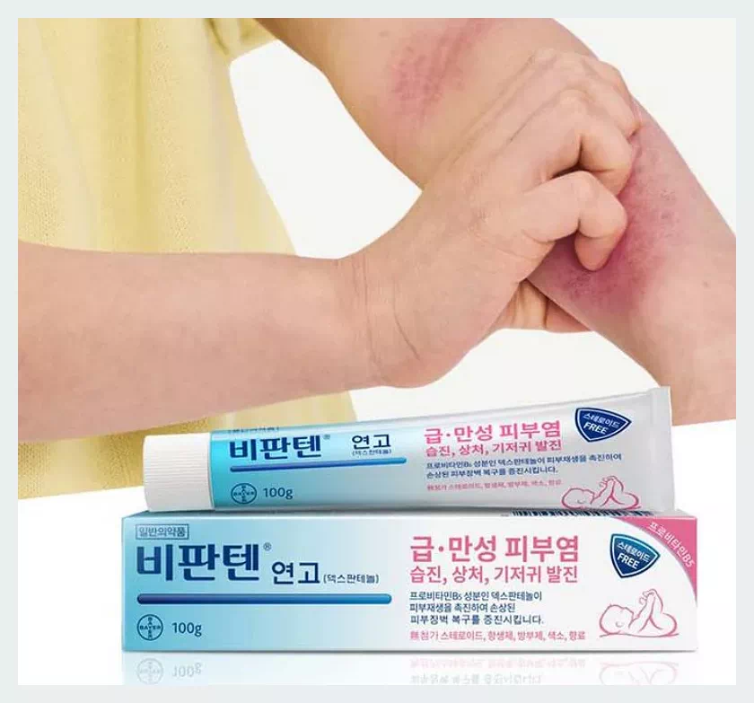 비판텐 연고:아토피 가려움증