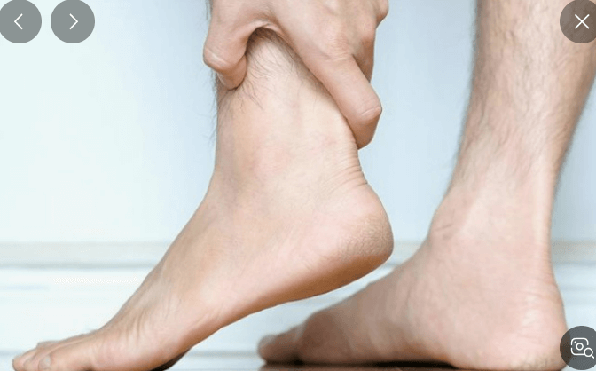 재발성 통풍 초기증상및 치료