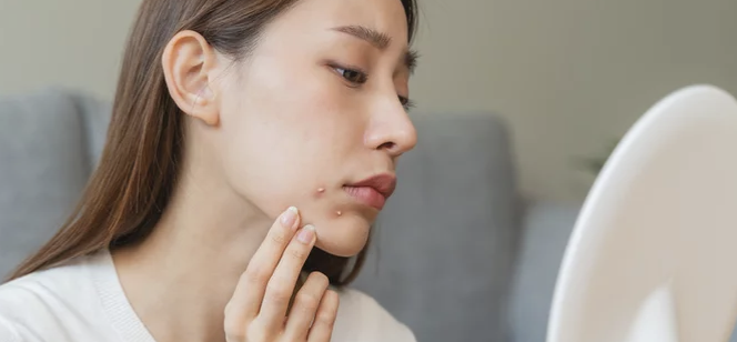 피부관리