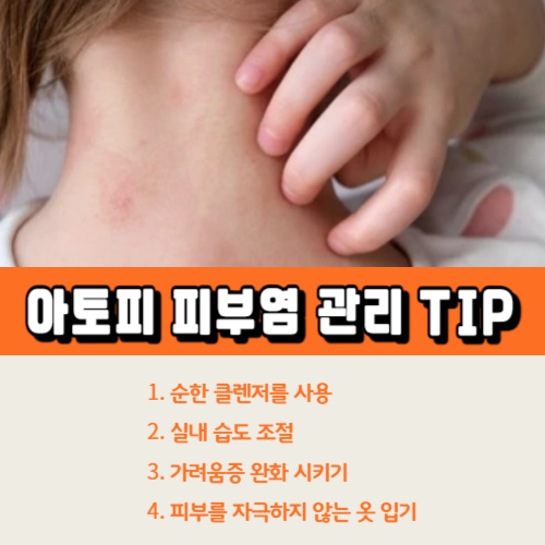 아토피피부염