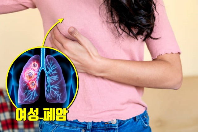 여성 폐암 원인 폐손상 자연치유,건강 팁줌 매일꿀정보