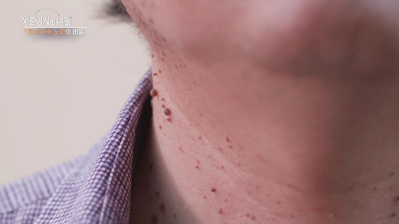 생로병사의 비밀 피부노화의 비밀
