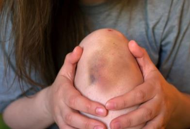 멍이 생기는 이유?