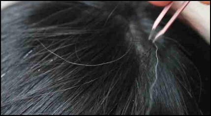 흰머리-뽑지-말아야한다