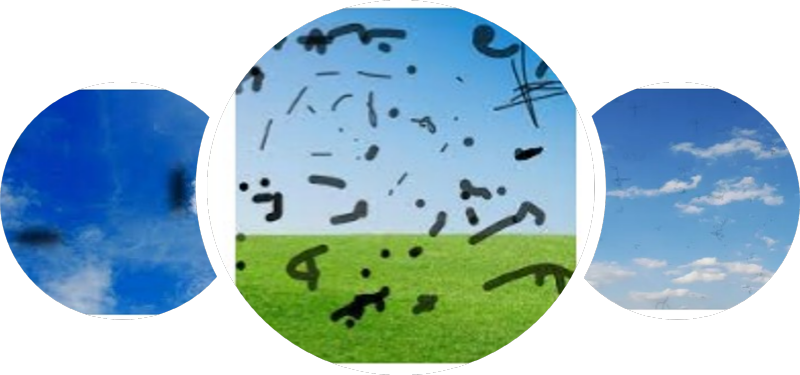 비문증 날파리증 증상