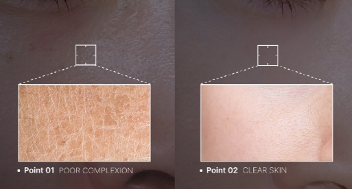 메디큐브 에이지알 부스터힐러