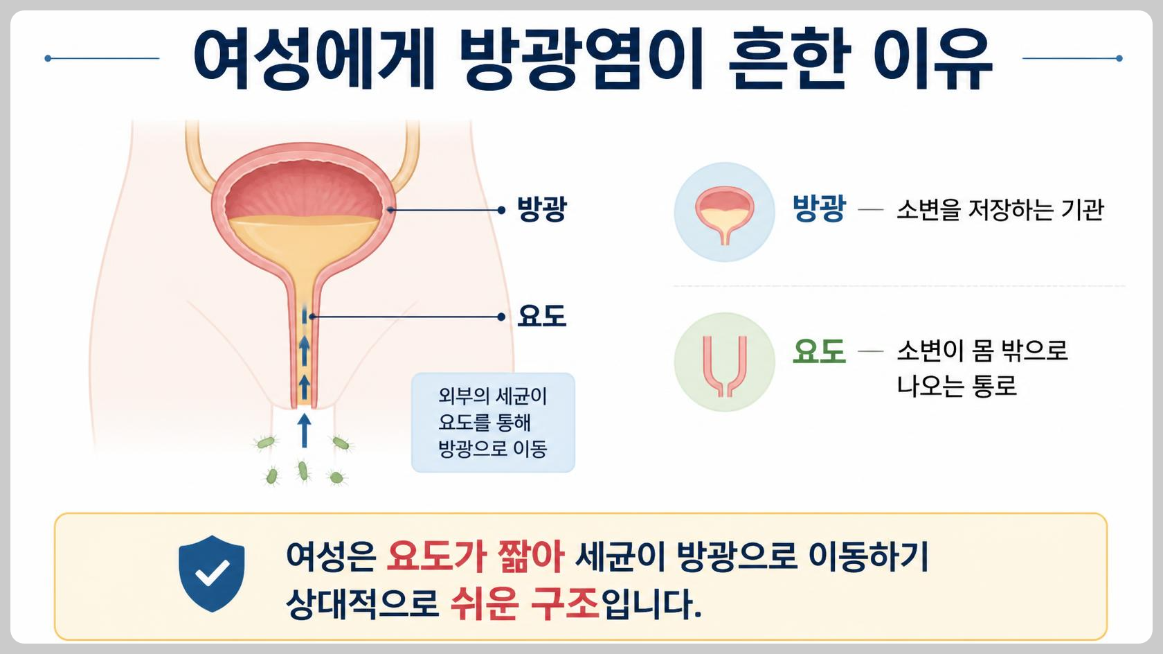여성 방광염과 관련된 방광과 요도 구조