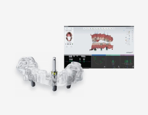 임플란트 가격비교