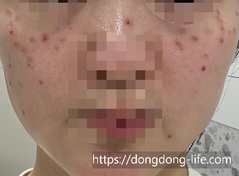 중계의원 기미 리뷰