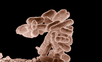 대장 염증 상태를 알 수 있는 검사 종류(대장검사, 대변검사, CRP)의 이미지