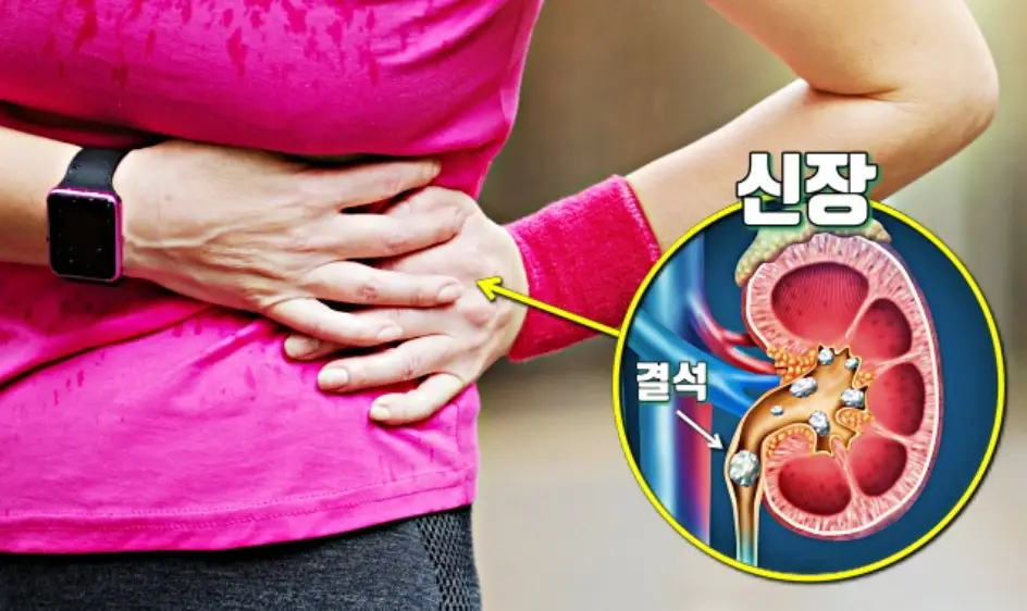 신장에 좋은 음식