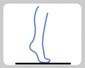 근육-강화-운동