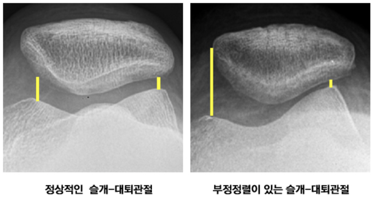 X-ray(Merchant view)