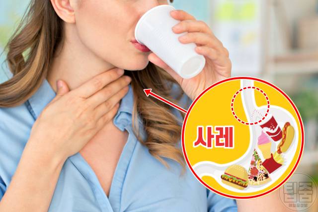 위암 증상,위암 초기증상 자가진단,삼킴장애