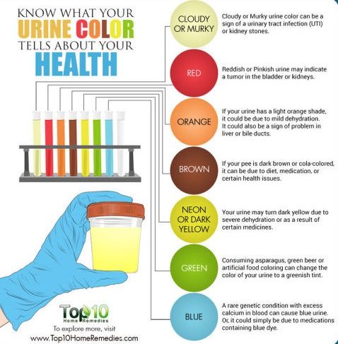 오줌 색깔과 병