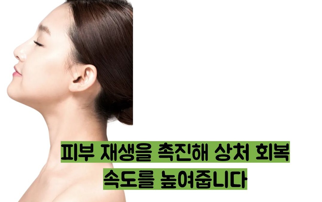 비판텐 연고 효능