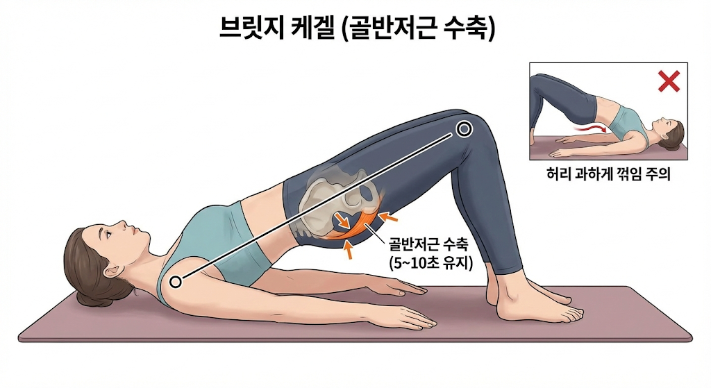 브릿지케겔운동