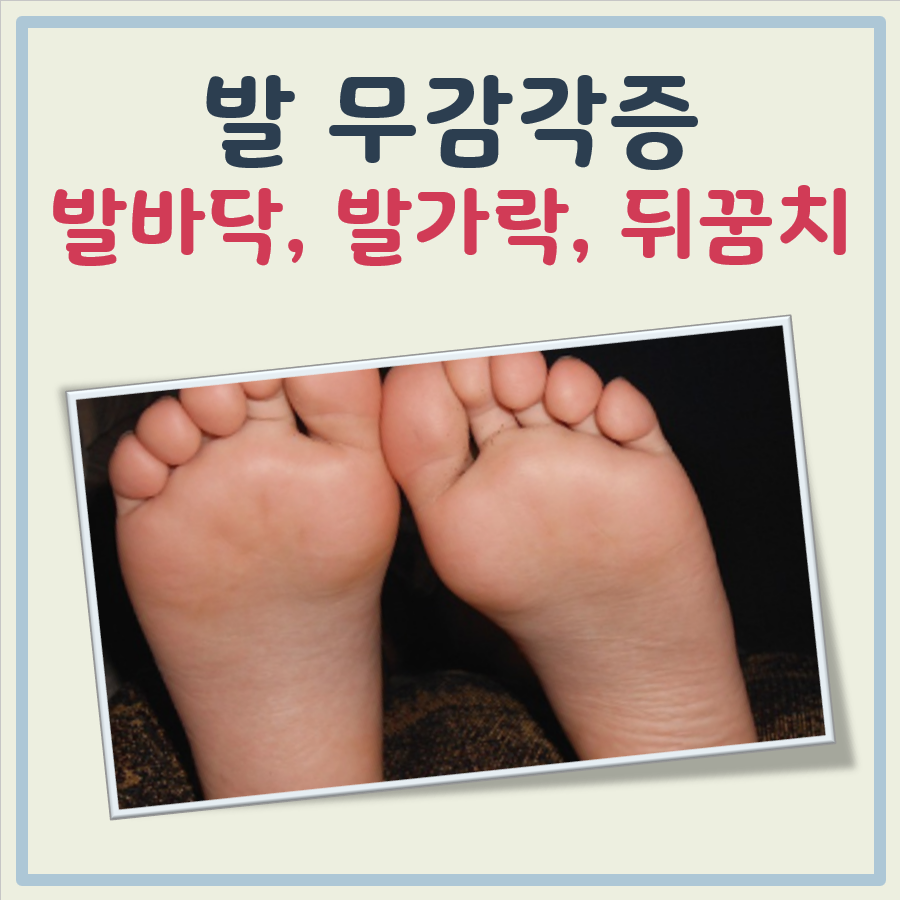 발 무감각 원인(발바닥, 발가락, 발뒤꿈치, 새끼발가락 등) 대표 이미지