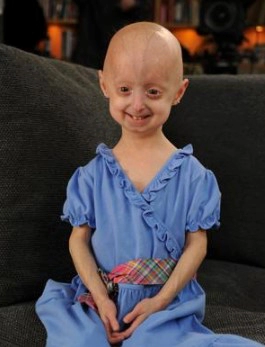 소아조로증 자주 묻는 질문 FAQ