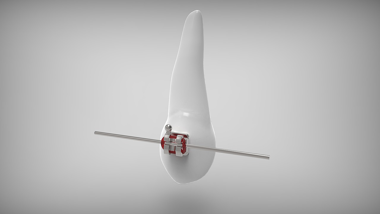 돌출입 교정 관련 사진