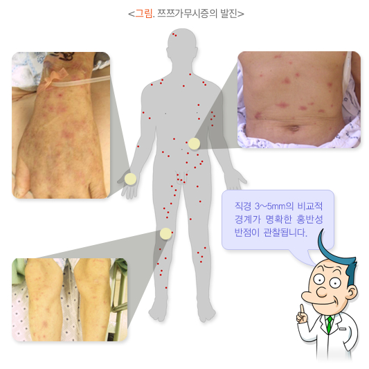 잘 생기는 위치