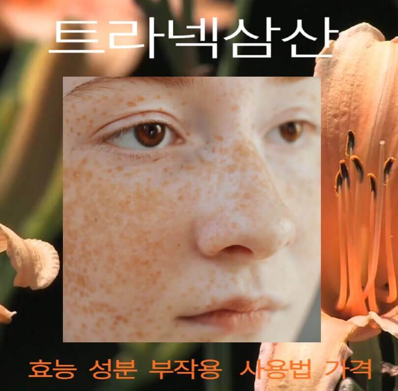 기미가-잔뜩-얼굴에-가득한-여성-얼굴-사진입니다.