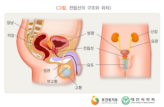 전립선 질환