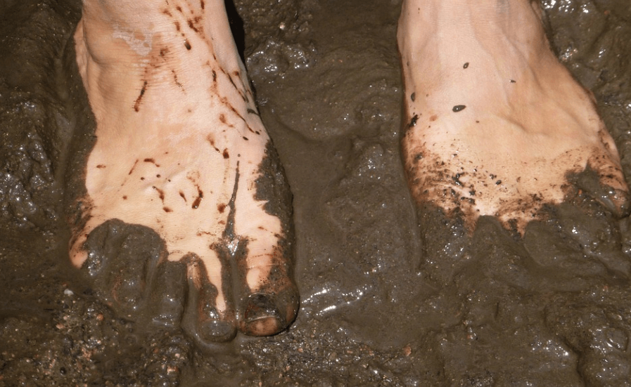 발등이 붓는 이유 - 6